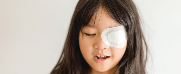 amblyopia treatment in ayurveda