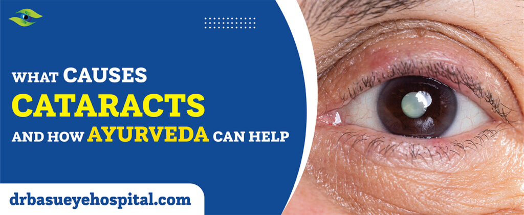 What Causes Cataracts