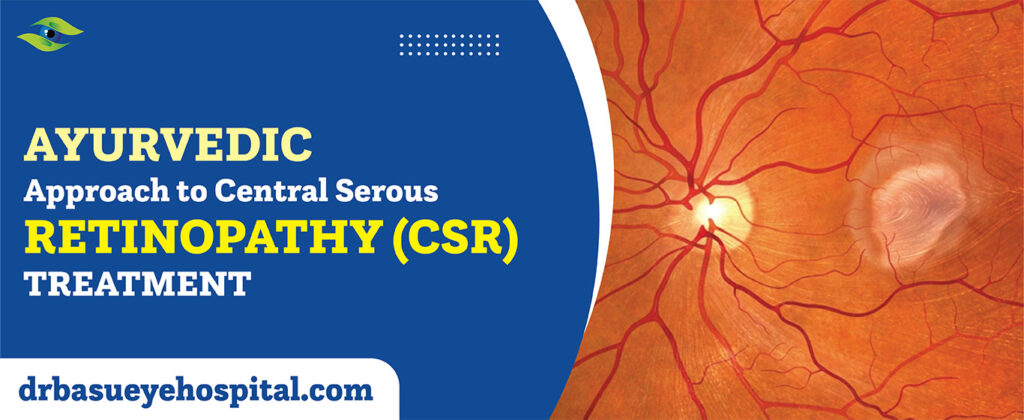 RETINOPATHY (CSR)