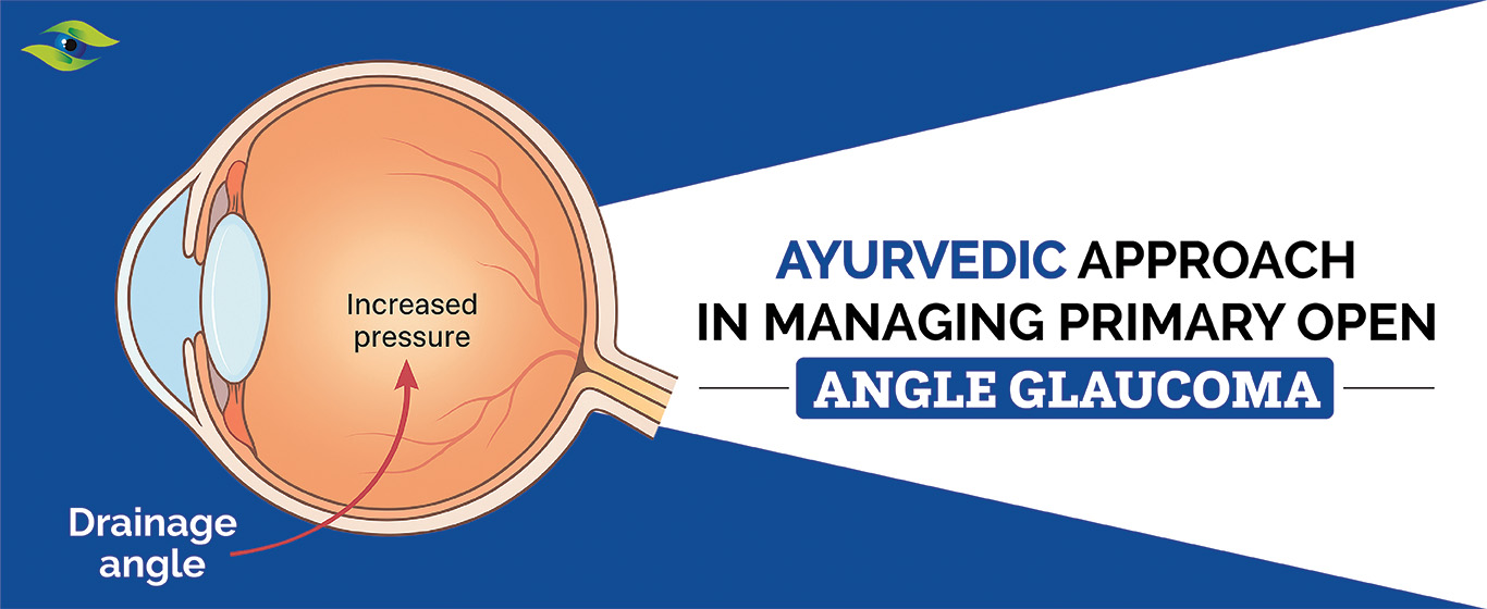 ANGLE GLAUCOMA
