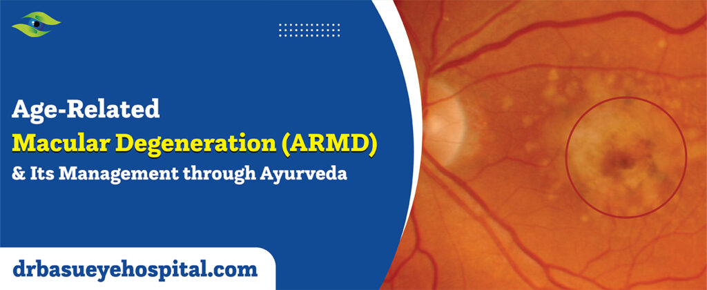 Macular Degeneration