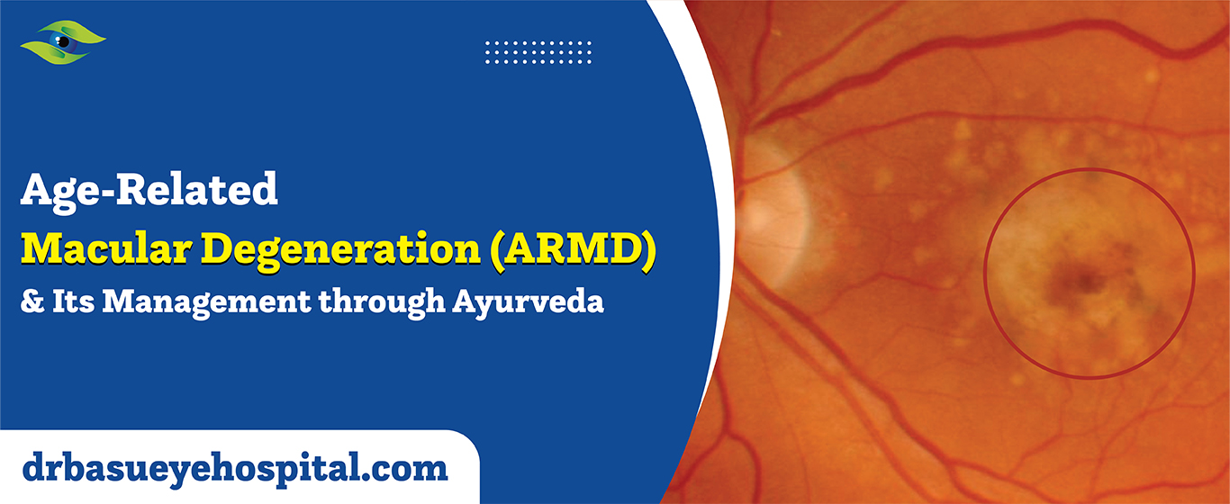 Macular Degeneration