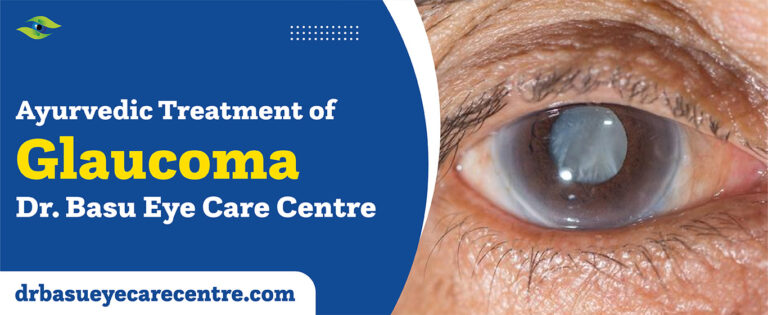 Ayurvedic treatment of glaucoma