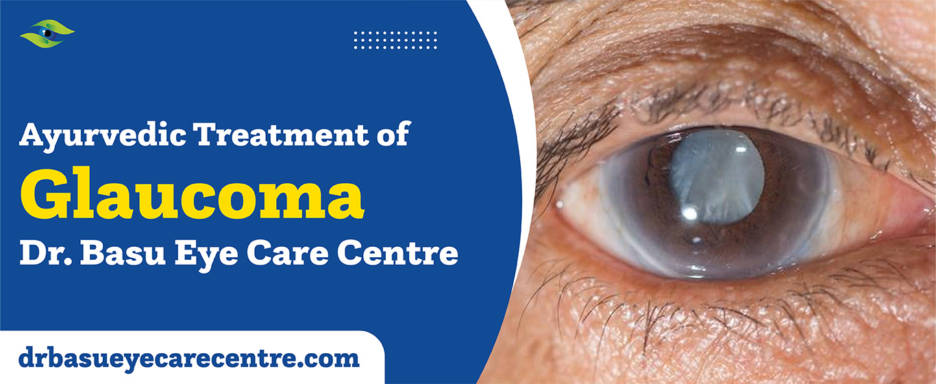Ayurvedic treatment of glaucoma
