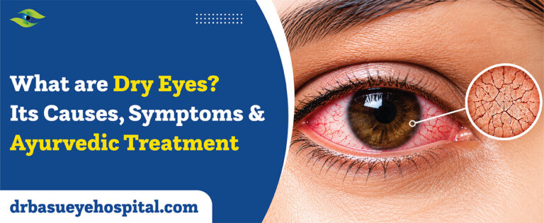 Dry Eyes_ Treatment